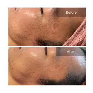 アロマ•ピーリング SalonYokoのその他イメージ