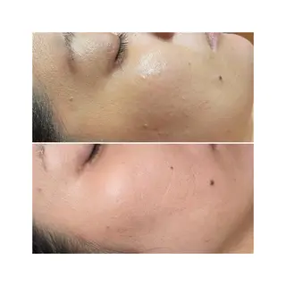 アロマ•ピーリング SalonYokoのその他イメージ