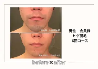 メンズ みんなの脱毛ツルリン ☀️船橋店☀️のエステ・リラクイメージ