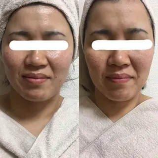 美筋骨格リンパ®️ Aroleのエステ・リラクイメージ