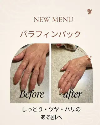 Kalama whitening salon所属・カラマ ホワイトニングサロンのその他イメージ