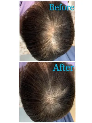 ヘアアレンジ Kanal Kanaのエステ・リラクイメージ