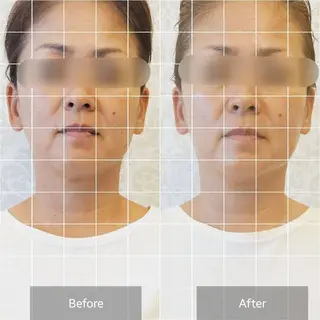 小顔・美肌ケア専門 Diva北浜のエステ・リラクイメージ