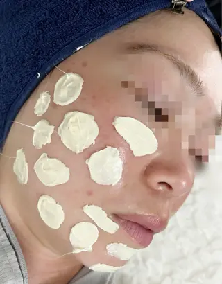 ネモア今泉/薬院店所属・nemoa天神・今泉 毛穴ケア/YUMIのエステ・リラクイメージ