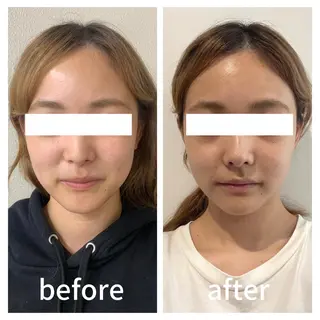 小顔サロン AMYONのエステ・リラクイメージ