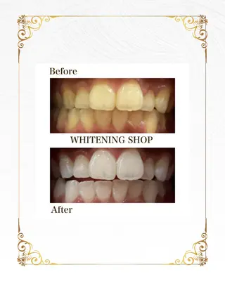 ホワイトニングショップ静岡葵区店所属・ホワイトニング ショップ葵区静岡駅店のその他イメージ