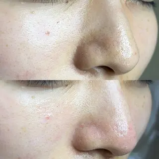 毛穴ケア・ヘッドスパサロンSHINY(シャイニー)所属・毛穴ケア・ヘッドスパ サロンSHINYのエステ・リラクイメージ