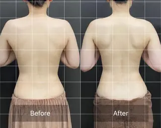 ニキビ・毛穴改善 🌿ハーブピーリングのエステ・リラクイメージ