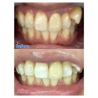 M渋谷店所属・Ｍ渋谷 ホワイトニングのエステ・リラクイメージ