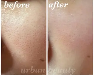 結果重視｜毛穴エステ ｜友綱理恵のエステ・リラクイメージ