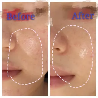 🅖🅤🅩🅔🅛 salonのエステ・リラクイメージ