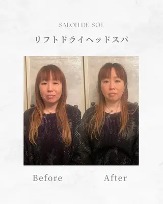 Salon de soé所属・上半身リンパケア Salondesoéのエステ・リラクイメージ