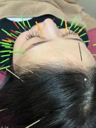 美容鍼灸女性専用 りんご鍼灸治療院のエステ・リラクイメージ