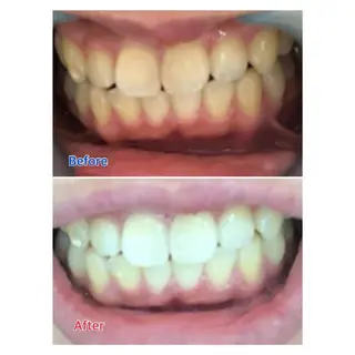 MBEAUTYSALON 千葉店・京成大久保所属・Melty 輝のその他イメージ