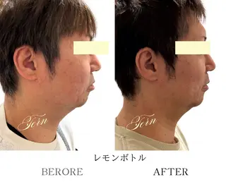 小顔・ニキビ・肌管理 TERN 南草津店のエステ・リラクイメージ