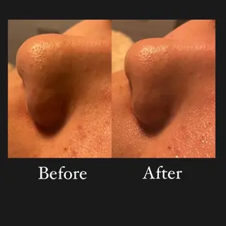 よもぎ蒸し専門店Artemisia所属・よもぎ蒸し専門店 Artemisiaのエステ・リラクイメージ