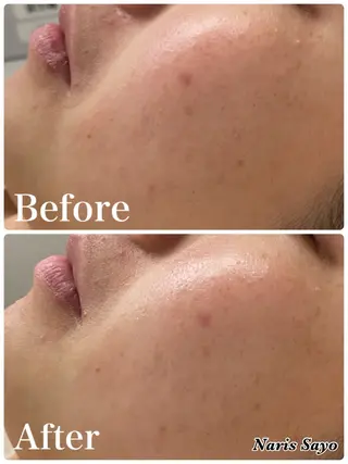 デ・アイム豊中所属・朝山 紗世子のエステ・リラクイメージ