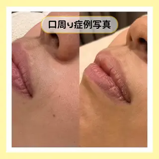 金山/脱毛/美肌 ULULUのエステ・リラクイメージ