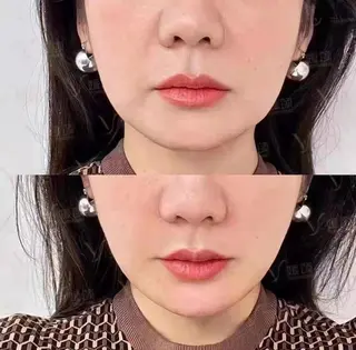 TUBOMI所属・関 久美子のエステ・リラクイメージ