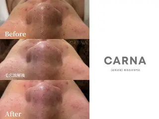 CARNA所属・【肌質改善専門店】 CARNAのエステ・リラクイメージ