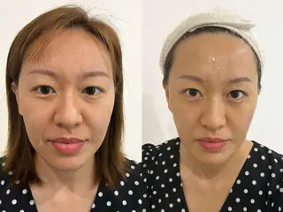 マツエク・マツパ aliaハイフ&水光ジェットサロン所属・aliaハーブ水光店 エステティシャン募集のエステ・リラクイメージ