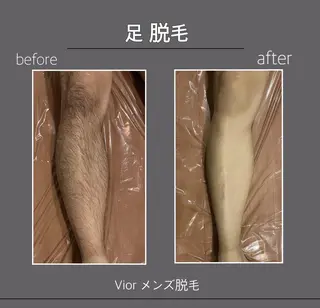 メンズ 栄 VIO Rのエステ・リラクイメージ