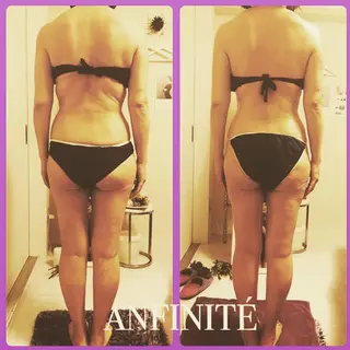 ANFINITÉ所属・ANFINITÉ アンフィニテのエステ・リラクイメージ