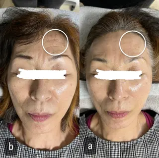 217whitening  room所属・217 ホワイトニングルームのエステ・リラクイメージ