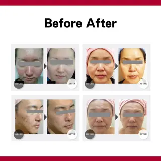 SHAPY HIGH SLIMMING ESTHETIC所属・嚴 キララのエステ・リラクイメージ