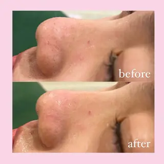 韓国肌管理専門店　White labo 宝塚店所属・有川 凜のエステ・リラクイメージ