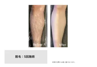 RIKKA所属・RIKKA☆脱毛/ アイブロウ/メイクのエステ・リラクイメージ