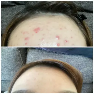 キッズ 美肌脱毛サロンGrande所属・別府脱毛サロン Grandeのエステ・リラクイメージ