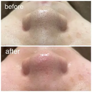 Reid-月詠-所属・Reid -月詠-のエステ・リラクイメージ