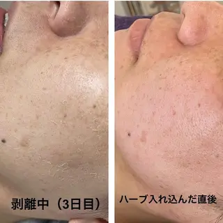 Biestora 郡山店/橋本のエステ・リラクイメージ