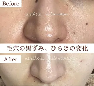 都度払い 肌質改善専門サロンのエステ・リラクイメージ