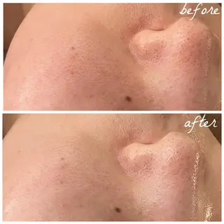 メンズ メナード岐阜市茜部 杉浦のエステ・リラクイメージ