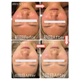 Beauty Salon Ciel Chiba所属・BeautySalo nCielChibaのエステ・リラクイメージ