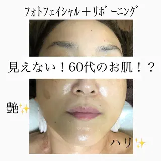 美肌脱毛と癒しのﾌﾟﾗｲﾍﾞｰﾄｻﾛﾝ。gratia~ｸﾞﾚｲﾃｨｱ~所属・gratia ~ｸﾞﾚｲﾃｨｱ~のエステ・リラクイメージ