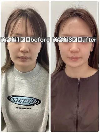 メディカルサロンドオフ所属・ハリサロンドオフ 美容鍼灸×小顔整体のエステ・リラクイメージ