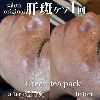 美肌salon GRAN CUORE所属・Natsuki🌙 GRAN CUOREのエステ・リラクイメージ