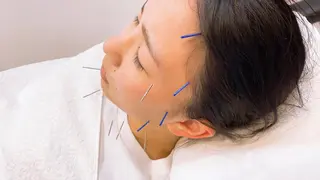 美容鍼灸Solana所属・肌質改善×美容鍼 ゆいのエステ・リラクイメージ