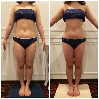 ハイパーナイフEX 小顔×痩身ケアのエステ・リラクイメージ