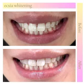 セルフホワイトニング エクシア五反田店のその他イメージ