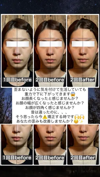 💎後悔させない小顔 矯正💎イトヤマ🌱のエステ・リラクイメージ