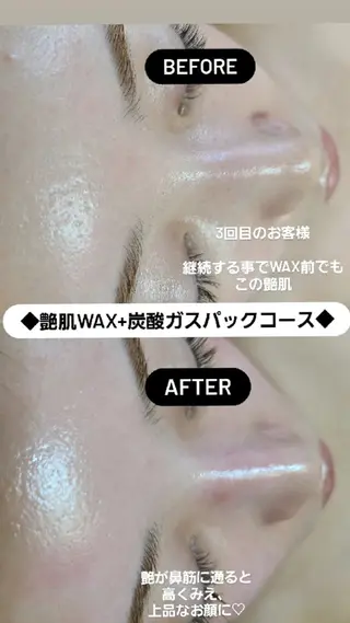 Premier 所属・寺西 さくらのエステ・リラクイメージ