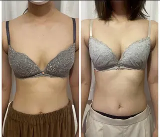 θTHETAメソッド　シエスタ所属・siesta バストアップ痩身のエステ・リラクイメージ