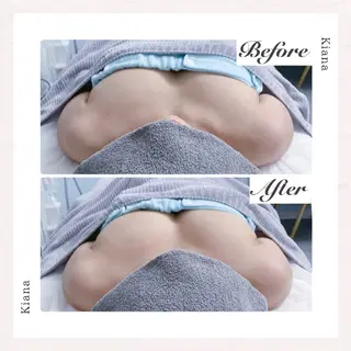 【バスト専門店 】 Kiana のエステ・リラクイメージ