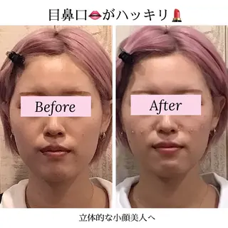 小顔矯正NAKA 筋膜/脂肪/毛穴洗浄のエステ・リラクイメージ