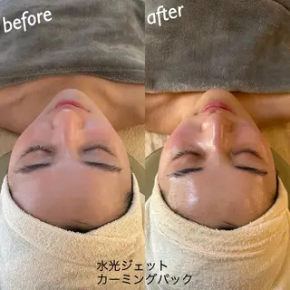 うなじ脱毛/美肌脱毛 LABELのエステ・リラクイメージ