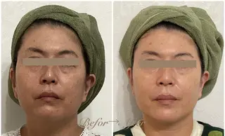 小顔専門店 グレイスボディ三郷店のエステ・リラクイメージ